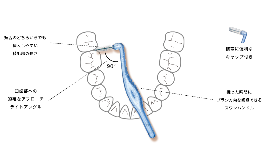 ”ワイヤーがどこに向いているかがはっきり認識できる”歯肉を傷つけないデザイン